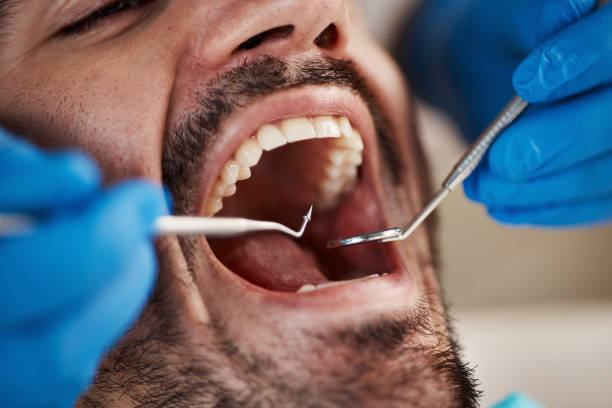 Best Broken or Cracked Tooth Emergency Dentist in Lamar, SC